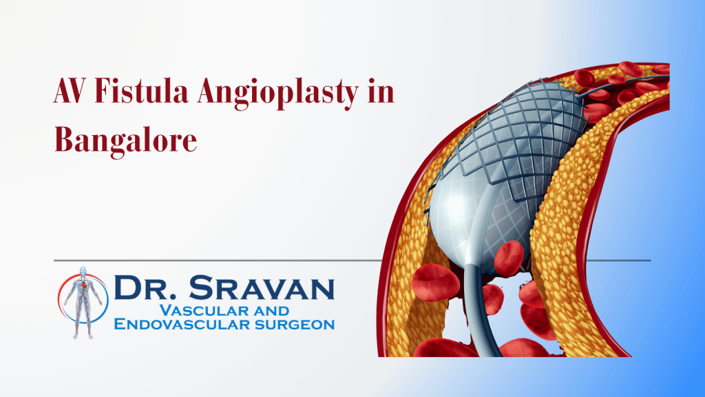 AV Fistula Angioplasty in Bangalore | AV Fistula Angioplasty in Bangalore