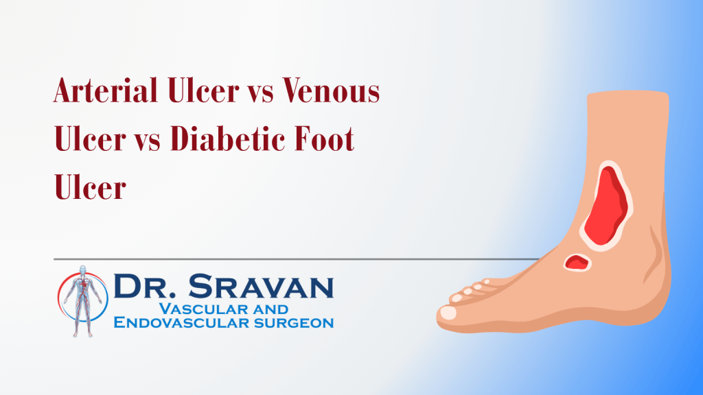 Arterial Ulcer vs Venous Ulcer vs Diabetic Foot Ulcer