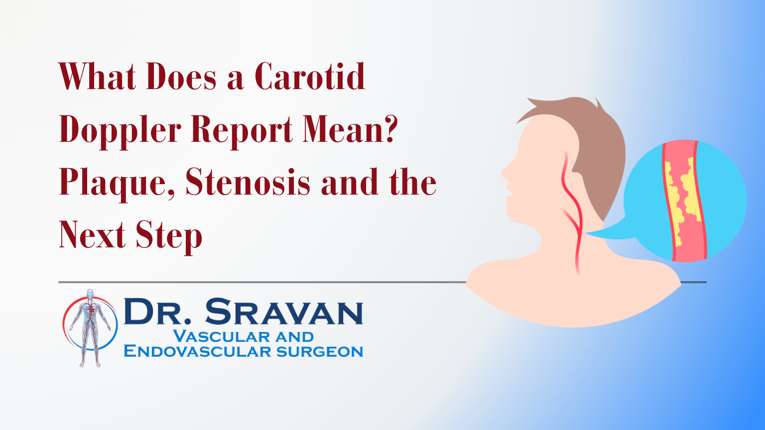 What Does a Carotid Doppler Report Mean? Plaque, Stenosis and the Next Step