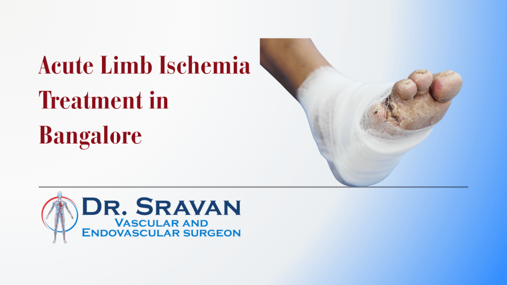 Acute Limb Ischemia Treatment in Bangalore | Acute Limb Ischemia Treatment in Bangalore
