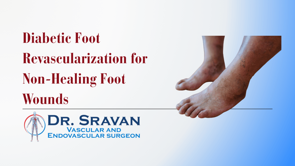 Diabetic Foot Revascularization for Non-Healing Foot Wounds | Diabetic Foot Revascularization for Non-Healing Foot Wounds