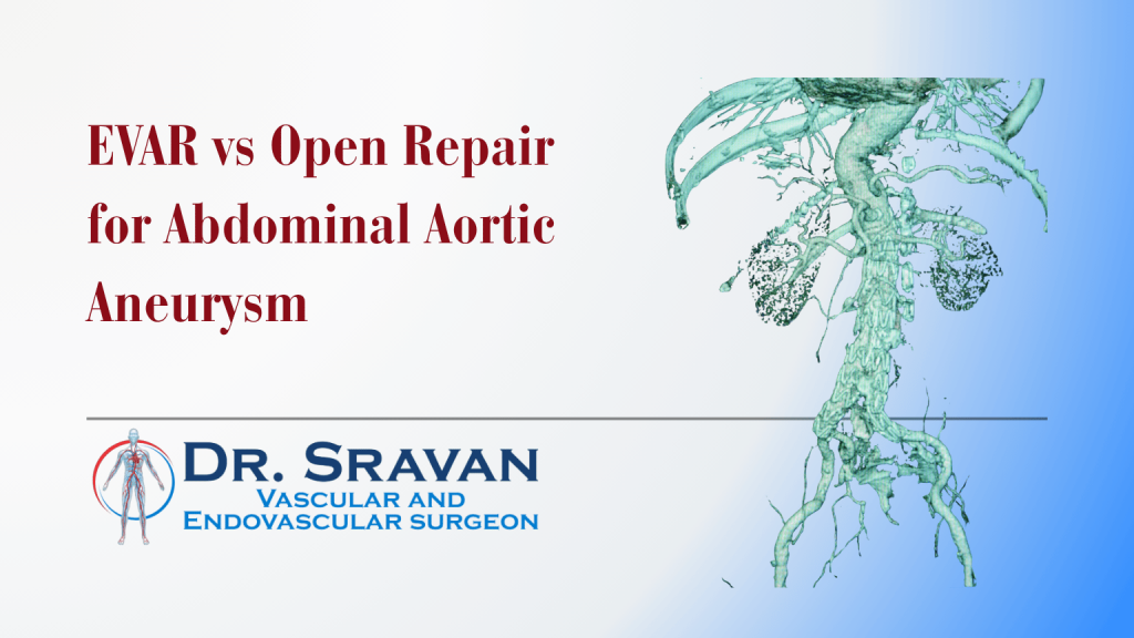 EVAR vs Open Repair for Abdominal Aortic Aneurysm | EVAR vs Open Repair for Abdominal Aortic Aneurysm