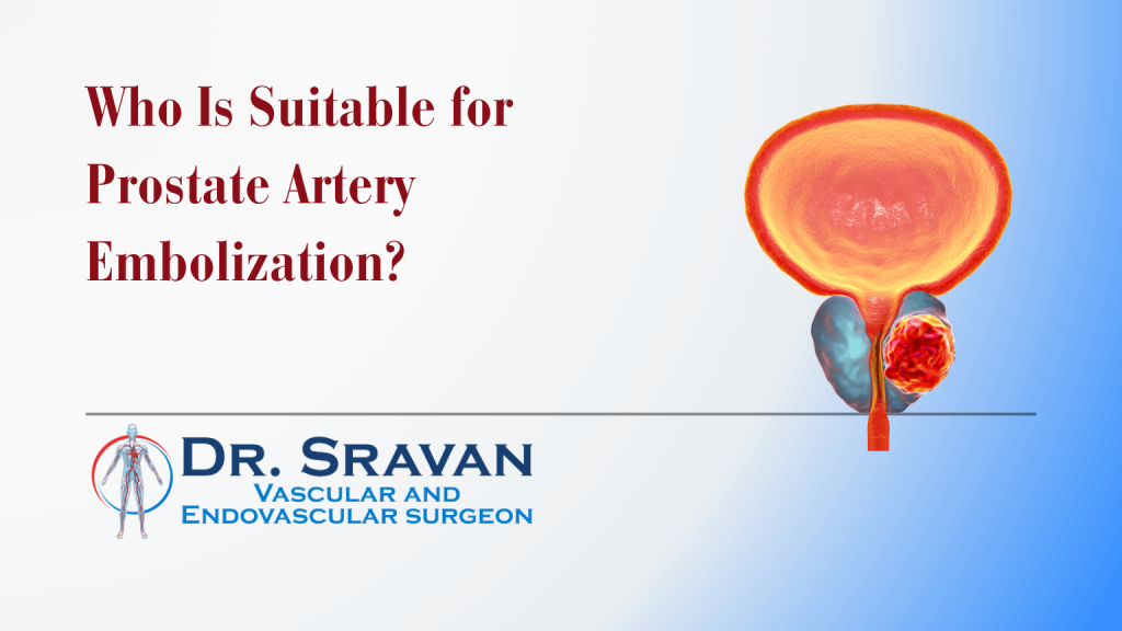Who Is Suitable for Prostate Artery Embolization? | Who Is Suitable for Prostate Artery Embolization?