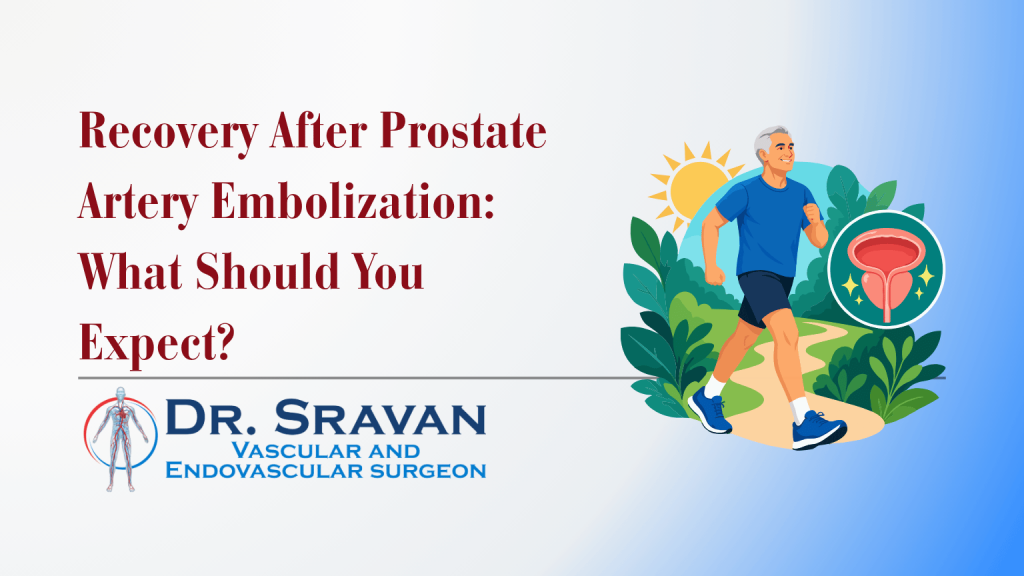 Recovery After Prostate Artery Embolization: What Should You Expect?