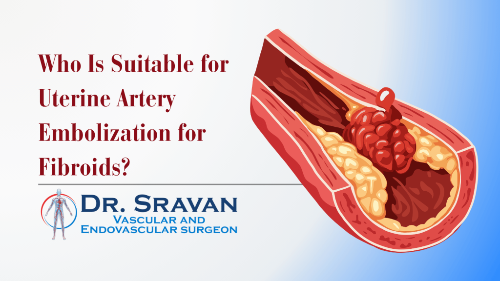 Who Is Suitable for Uterine Artery Embolization for Fibroids? | Dr. Sravan CPS Who Is Suitable for Uterine Artery Embolization for Fibroids?
