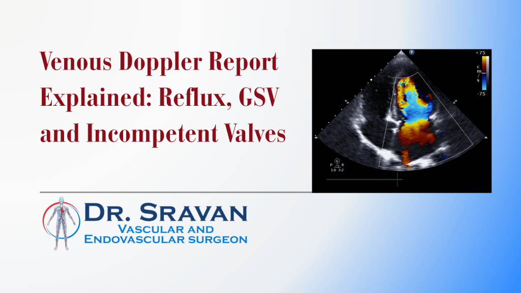 Venous Doppler Report Explained: Reflux, GSV and Incompetent Valves | Dr. Sravan CPS Venous Doppler Report Explained: Reflux, GSV and Incompetent Valves