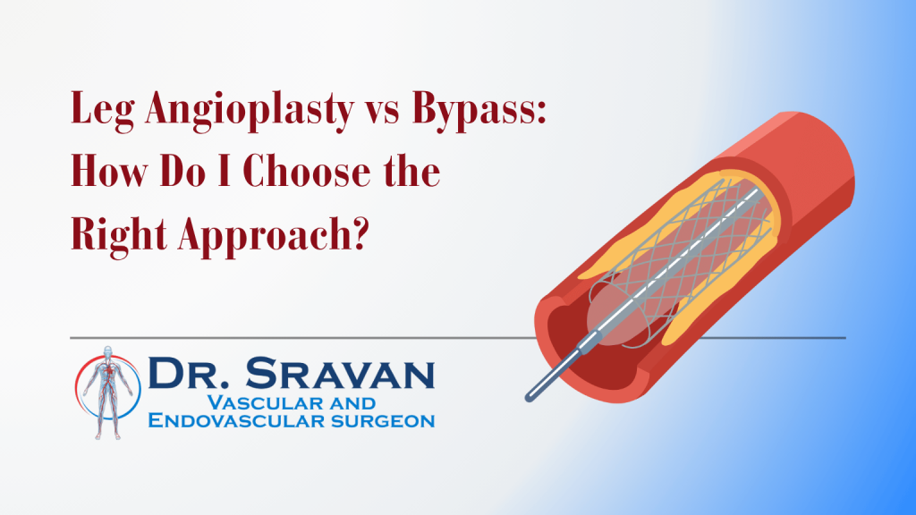 Leg Angioplasty vs Bypass: How Do I Choose the Right Approach? | Dr. Sravan CPS Leg Angioplasty vs Bypass: How Do I Choose the Right Approach?